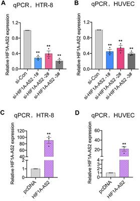 A novel regulated network mediated by downregulation HIF1A-AS2 lncRNA impairs placental angiogenesis by promoting ANGPTL4 expression in preeclampsia